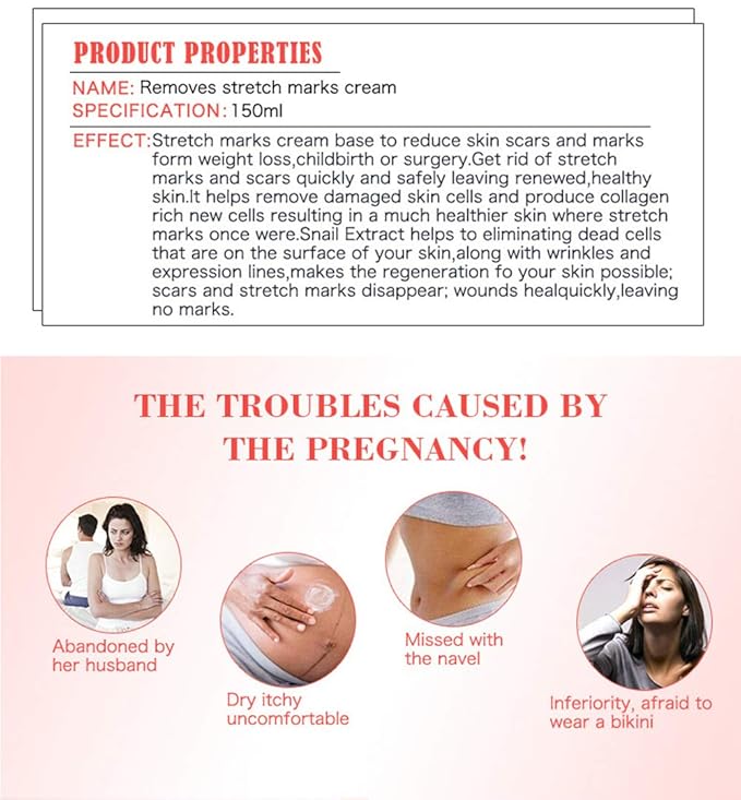 AICHUN BEAUTY Pregnancy Cream Streach Mark Remover Scars Repair Cellulites Lotion Cream 150ml