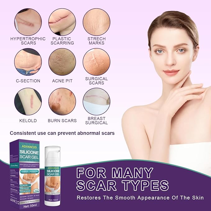 Silicone Scar Cream Scar Gel - Advanced Scar Gel Scar Treatment for Stretch Marks Removal, Old & New Scars, Surgical Scars, Burns, Acne, C-Section, Keloid Scar Treatment for Women & Men, 1.76Oz