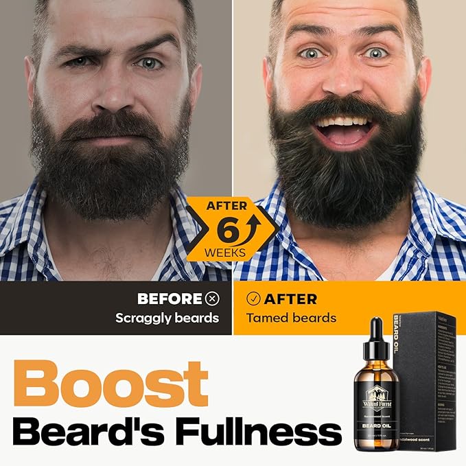 Waking Forest Beard Oil - Biotin Beard Oil for Men Thicker Beard with Vitamin E, Rosemary, Castor Mustache Oil for Black Men, Softens & Strengthens Beard Care Oil (Unscented, 2oz)