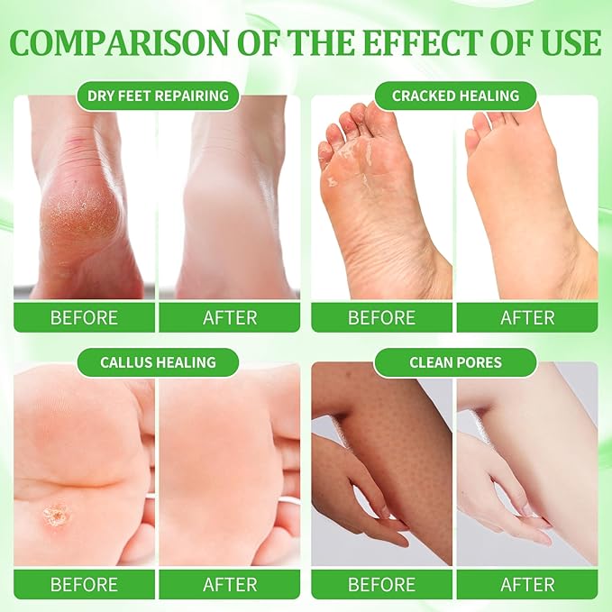 Pedicure Kit Foot Soak Set: Bubble Salt, Sugar Scrub, Massage Mask, Massage Lotion in a Box, 4 Step Foot Spa Kit for Dry Feet, Calluses and Tired Feet（3 Set Peppermint）