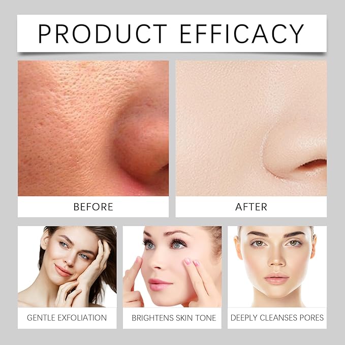 Rice Water Duo Exfoliating & Brightening Ampoules -2x100ml Gentle Facial Peel for Smooth SkinTextureDaily Exfoliator with RiceBran Extract FDA-Certified SkinRenewal Booster for All Skin Types