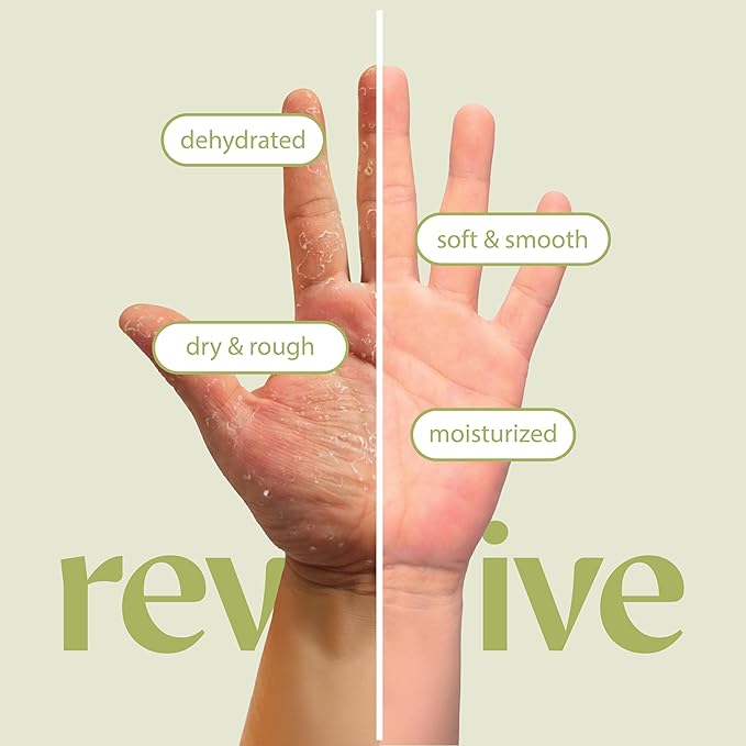 12 Pairs Original Derma Beauty Hand Mask Bulk, Moisturizing Hand Gloves for Dry Hands, Nail Care Essential (Avocado)