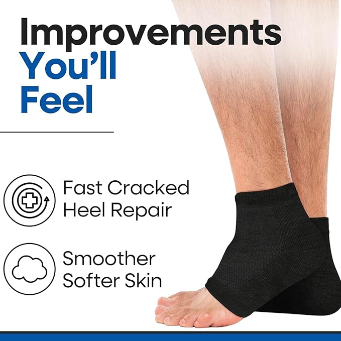 Moisturizing Socks | Cracked Heel Treatment with Aloe Vera | Moisturizer Foot Callus Remover | Aloe Socks for Cracked Heels & Dry Cracked Feet | Lotion Infused Gel Heel Socks (Fits Most)