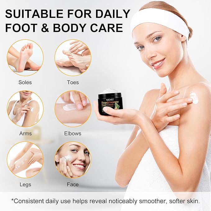 Frankincense Foot Cream 5.29oz, Frankincense Balm for Skin, Feet and Body Care, Deep Moisturizing and Soothing Skin with Pure Essential Oils for Dry, Cracked Heels