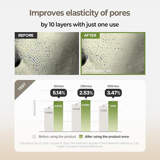 SKINFOOD Rice Daily Serum, Korean Skincare Facial Essence for Glow Glass Skin, Fermented Natural Rice Water Milk for Face, Pore Minimizing, Deep Hydrating, Dark Spot Correcting, 55ml/1.86fl.oz.