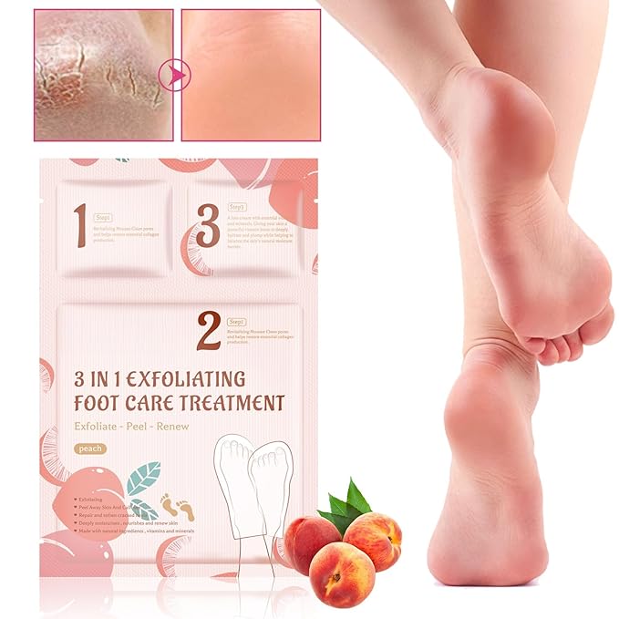 3-in-1 Foot Peel Mask Kit – Exfoliating Foot Care Treatment with Cleansing Mousse, Peeling Socks & Hydrating Cream (Peach Extract) for Dry Cracked Heels, Calluses & Dead Skin 2pcs