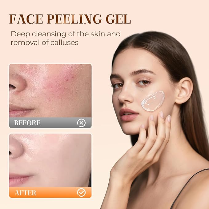 Facial Exfoliating Gel, 2025 New Orange Exfoliating Gel Scrub for Face and Body, Orange Peeling Glue Remove Blackheads & Moisturize Skin for All Types Skin (A-1Pcs, One Size)