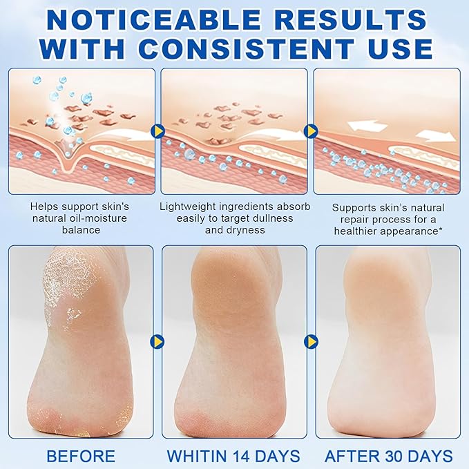 Urea Cream 60% Plus Salicylic Acid 2% Foot Balm Stick for Dry Cracked/Chapped Heel, Skinned knees, Hand Intensively Hydration & Moisturization, Callus Removal & Softening, Soothing|1.41 Oz/40 G