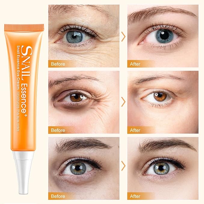 Snail Eye Cream for Dark Circles and Puffy Eyes Eye Bags Remover, Eye Cream Anti Aging, Under Eye Cream, Reduce Lines Wrinkles Puffiness and Dark Circles for All Skin Types