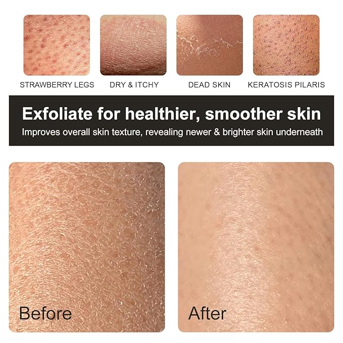 Korean Exfoliating Mitt, Deep Exfoliating Glove, 3pc Body Exfoliator Glove, Body Scrubber Exfoliator, Bath Shower Scrub Gloves, Self Tan Remover, Smooth Skin, Keratosis Pilaris Removal