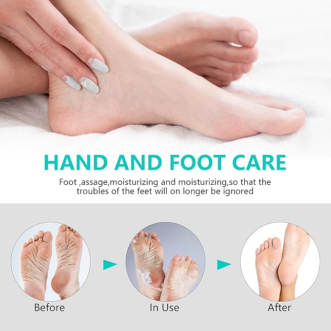 2 Packs Urea Cream 40 Percent for Feet Maximum Strength, Urea Foot and Hand Cream with Powerful Hydration for Dry Skin, Cracked Heels, Deeply Moisturizing for All Skin Types 7.05oz
