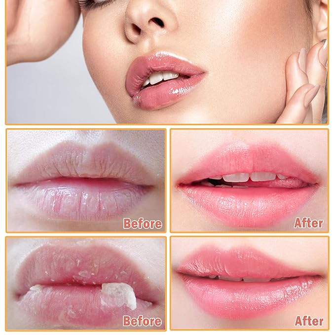 2Pcs Honey Pot Bee Lip Balm with Honey Spoon,Honey Lip Sleeping Mask Overnight 24HR Repair Lip Reduces Lip Lines,Exfoliator Moisturizing Moisture Dry & Chapped Lip Care Products