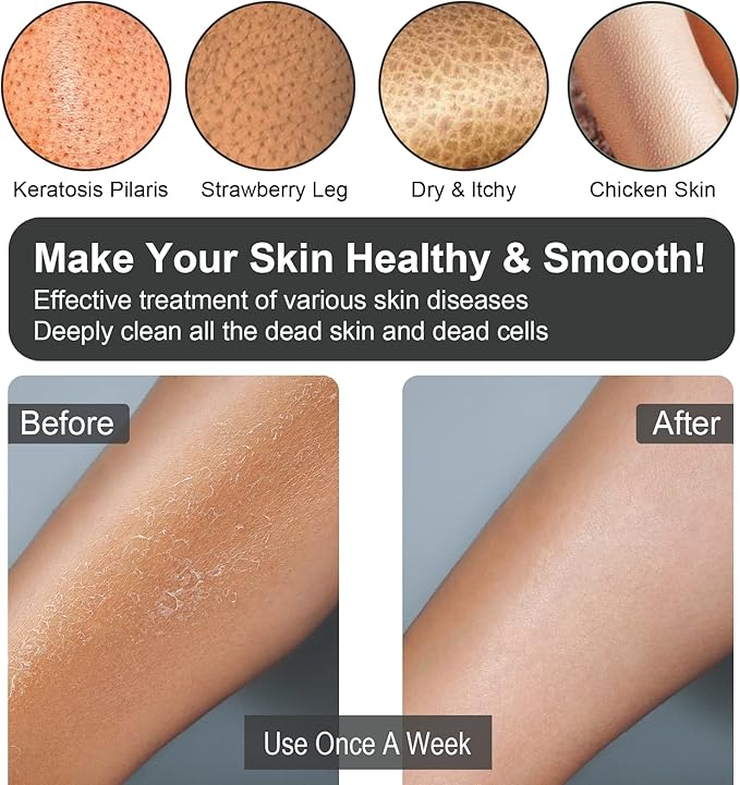 Exfoliating Gloves 2 Pcs, Exfoliating Body Scrubber for Bath Shower Exfoliation, Body Scrub Exfoliator Loofah Sponge for Dead Skin Remover, Korean Exfoliating Mitt (Black)