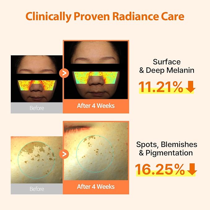 DERMAFIRM Peptology Niacinamide Vitamin C Ampoule - GLASS SKIN with 15% Niacinamide Brightening Ampoule with Glutathione for Dark Spot Correction & Radiance Boost - Korean Skincare 30ml