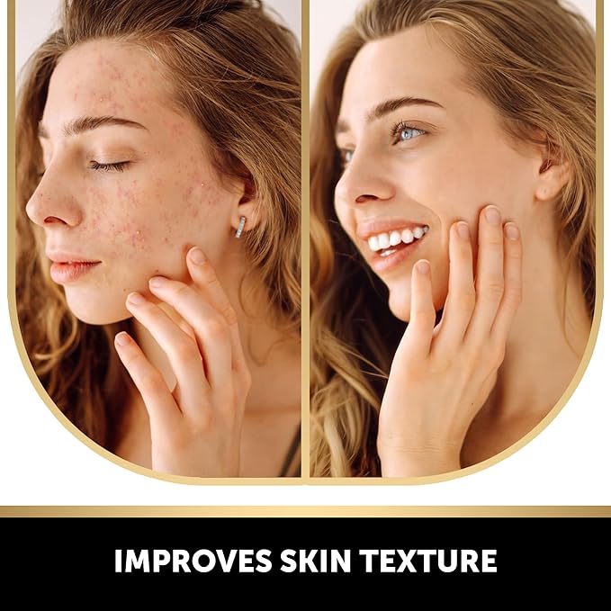 VALITIC Kojic Acid Vitamin C and Retinol Soap Bars with Turmeric for Dark Spot - Original Japanese Complex Infused with Collagen, Hyaluronic Acid, and Vitamin E (2 Pack)