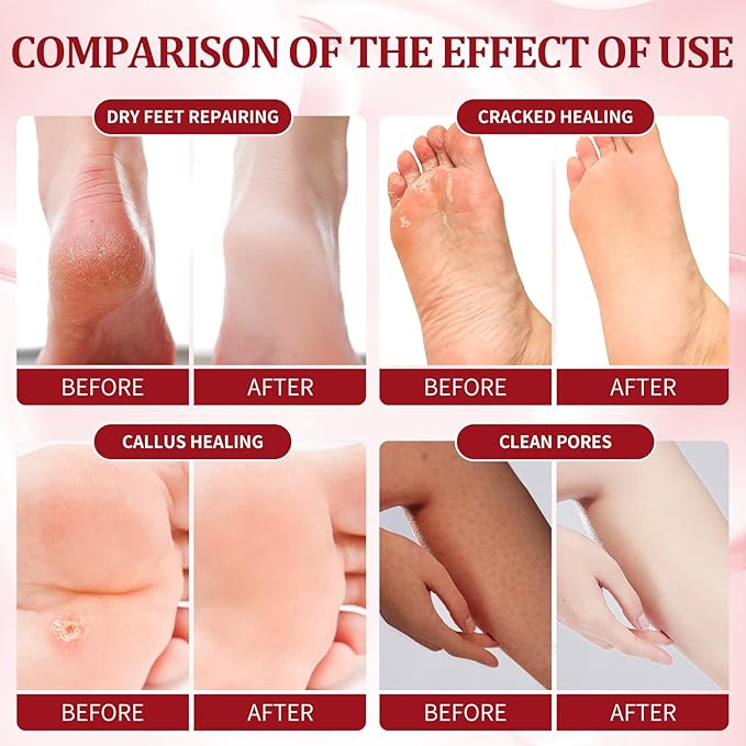 Pedicure Kit Foot Soak Set: Bubble Salt, Sugar Scrub, Massage Mask, Massage Lotion in a Box, 4 Step Foot Spa Kit for Dry Feet,Tired Feet（3 Set Pomegranate)