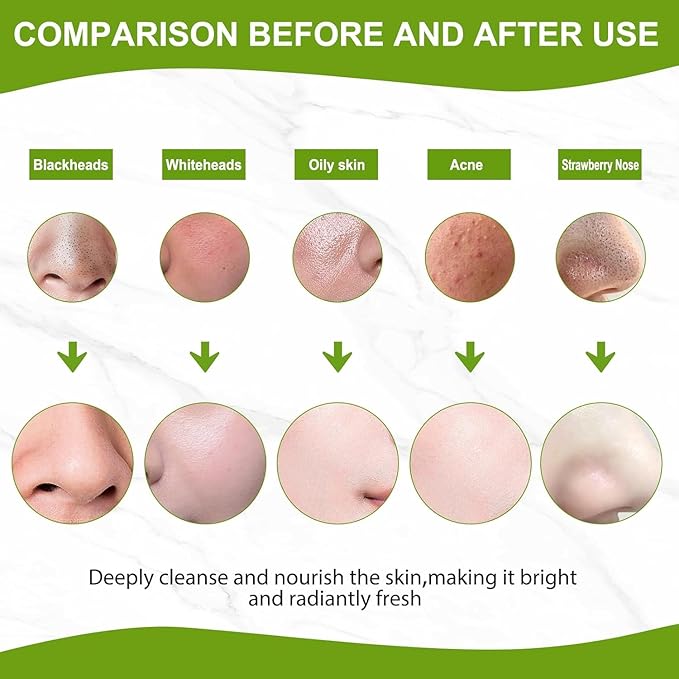 Blackhead Remover Mask, Charcoal Peel Off Face Mask | Charcoal face Mask for Deep Cleansing Dirts, Pores, Acne, Skin Oil and Blackheads | Suitable for all skin types for boys and girls(2.8 Fl Oz)