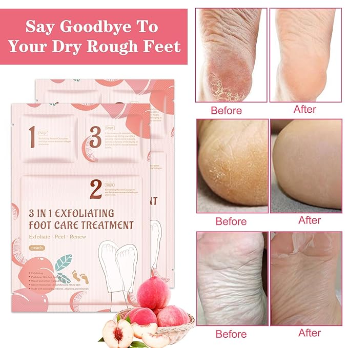 3-in-1 Foot Peel Mask Kit – Exfoliating Foot Care Treatment with Cleansing Mousse, Peeling Socks & Hydrating Cream (Peach Extract) for Dry Cracked Heels, Calluses & Dead Skin 2pcs