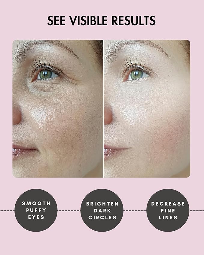 Under Eye Patches for Dark Circles and Puffiness - (15 pairs) Collagen Eye Masks with Natural Extracts for Wrinkle Reduction, Puffy Eyes & Eye Treatment Gels