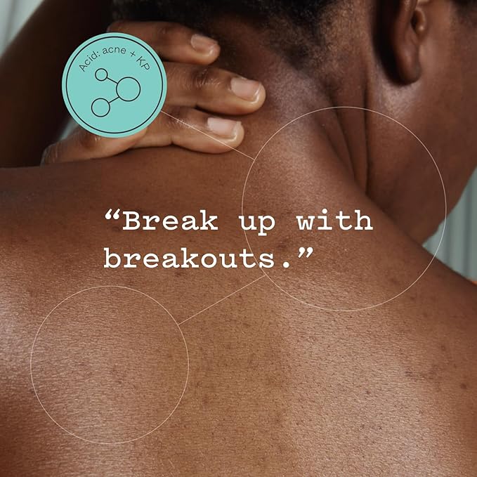 Glycolic Acid Body Scrub | Breakout Busting, KP & Spot Stopper, Dual Exfoliation with Glycolic Acid & Pumice | Reduces Acne with Niacinamide & Soothes Redness with Witch Hazel | 8.82 oz | Pack of 1