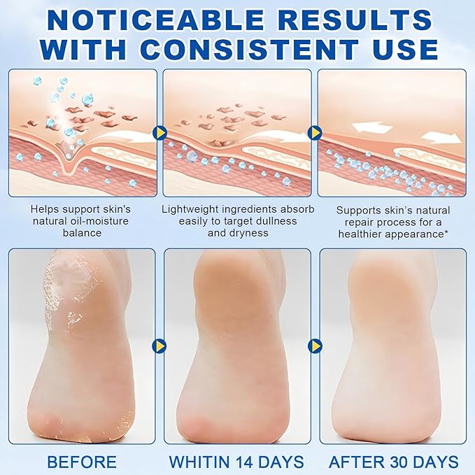 Urea Cream Stick 60% plus 2% Salicylic Acid， Deeply Moisturising and Fast Absorbing Gentle Exfoliation For Dry sink Exfoliating Dead Skin, Callus Remover ， Skin Softener