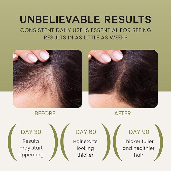 Batana Oil For Hair Growth - 100% Pure, Raw & Natural Blend With Organic Castor, Pumpkin Seed, Coconut and Rosemary Oil - Thicker, Stronger Hair For Men & Women Scalp (1 Pack)