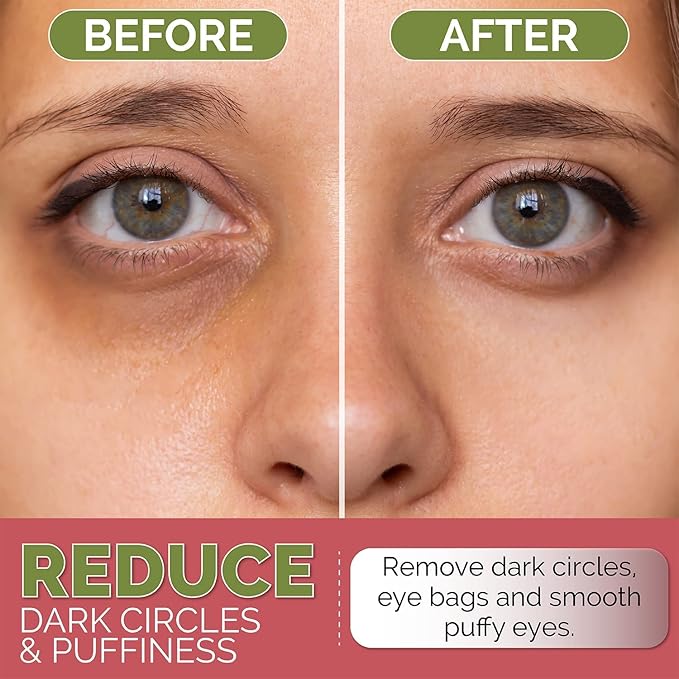 LOOKATME Korean Eye Mask for Dark Circles and Puffiness, Hydrogel Eye Patch for Eye Bags with Rose Gold (60pcs x 2pk), Eye Masks for Puffy Eyes, Hyaluronic Acid and Collagen, Premium Eye Gel Pads