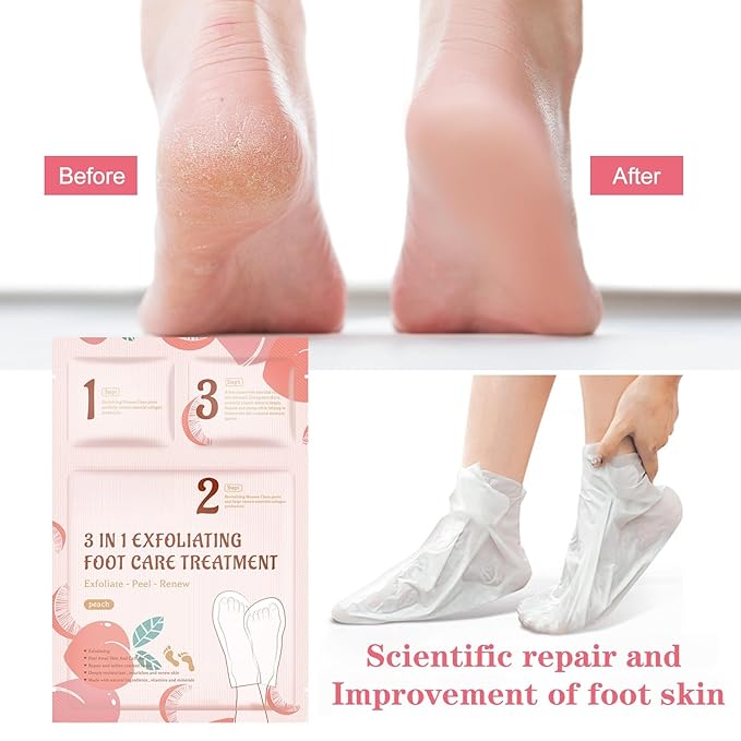 3-in-1 Foot Peel Mask Kit – Exfoliating Foot Care Treatment with Cleansing Mousse, Peeling Socks & Hydrating Cream (Peach Extract) for Dry Cracked Heels, Calluses & Dead Skin 2pcs