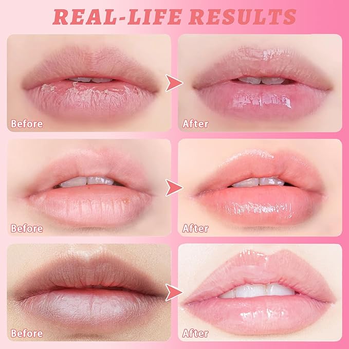 3 Pcs Honey Lip Balm, Bee Lip Balm Honey Pot,Moisturizing Lip Mask Overnight,Hydrate Repair Prevent Dry Cracked Lip Care (Honey+Strawberry+Watermelon)