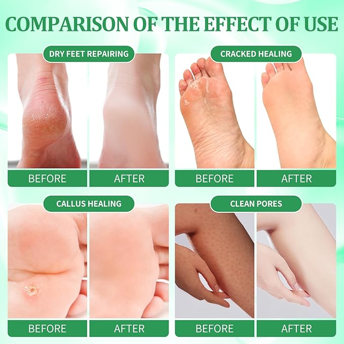 Pedicure Kit Foot Soak Set: Bubble Salt, Sugar Scrub, Massage Mask, Massage Lotion in a Box, 4 Step Foot Spa Kit for Dry Feet,Tired Feet（3 Set Eucalyptus)