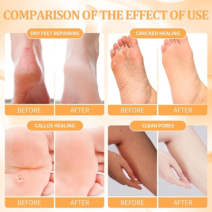 Pedicure Kit Foot Soak Set: Bubble Salt, Sugar Scrub, Massage Mask, Massage Lotion in a Box, 4 Step Foot Spa Kit for Dry Feet, Softens Calluses and Tired Feet（1 Set Orange)