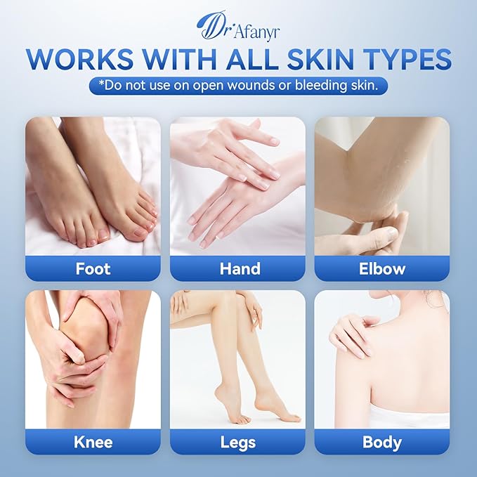 40% Urea Cream for Feet – Foot Cream for Dry Cracked Heels Hand Elbows, Urea 40 percent Foot Lotion for Moisturizing Skin, with 2% Salicylic Acid for Callus Remover & Repair (5.29oz)