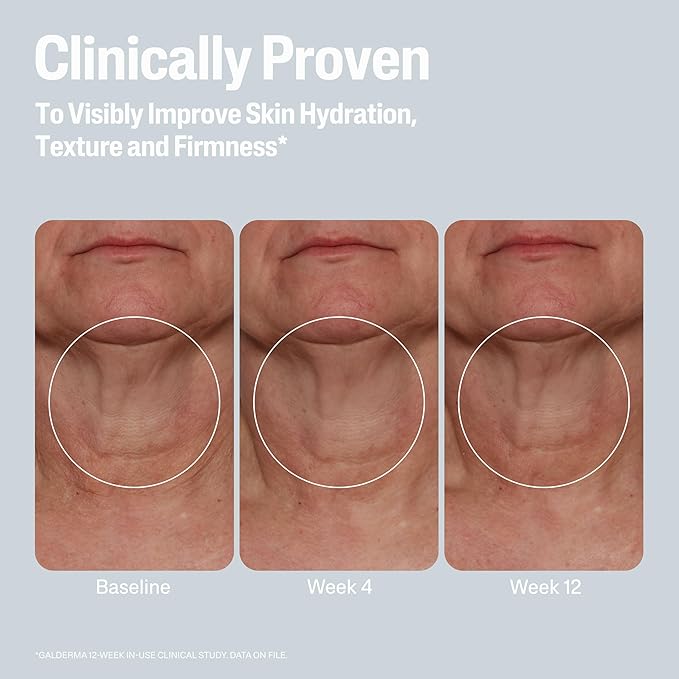 Cetaphil Skin Activator Hydrating & Firming Cream For Face, Neck & Chest 3.4 oz, Mandelic Acid (AHA) and Centella Asiatica (CICA) Cream, Hydrates and Firms Aging, Anti-Aging Skin Care