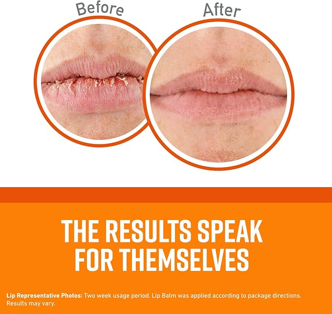 O'Keeffe's Unscented Lip Repair Lip Balm for Dry, Cracked Lips, Stick, (Pack of 11)