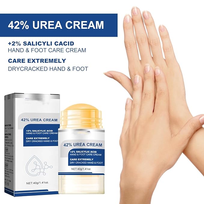 Soelegant Urea Cream, Urea Foot and Hand Cream for Dry, Cracked, Callus and Dead Skin, Moisture Stick for Foot Care, Cracked Heel Treatment, Knees, Elbows, Hands, Repair,