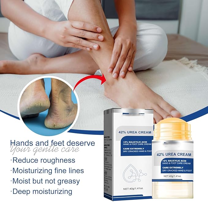 Soelegant Urea Cream, Urea Foot and Hand Cream for Dry, Cracked, Callus and Dead Skin, Moisture Stick for Foot Care, Cracked Heel Treatment, Knees, Elbows, Hands, Repair,