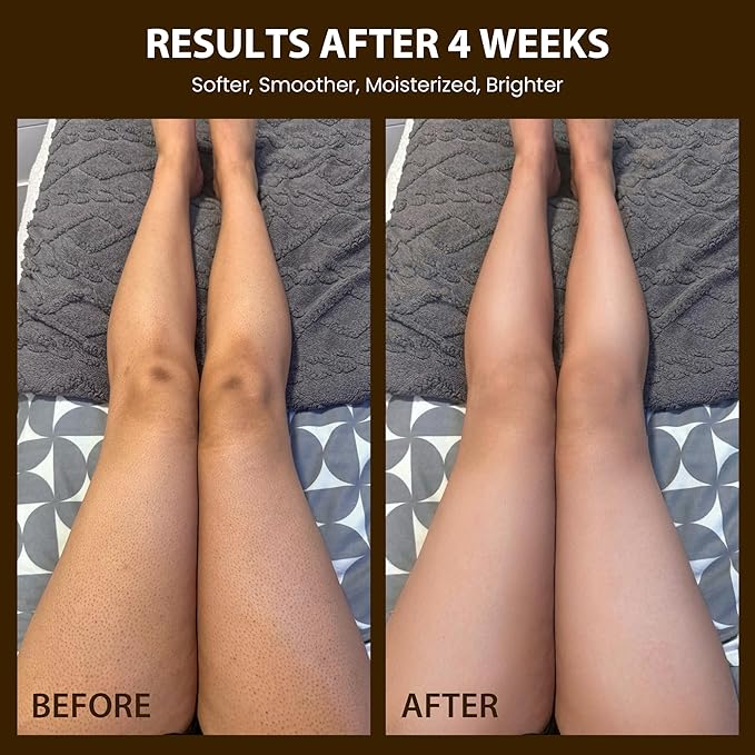 Organic Robusta Coffee Body Scrub 8 oz with Coconut Oil & Shea Butter - Moisturizing and Exfoliating Body, Face, Hand, Foot Scrub - Cellulite, Fight Stretch Mark, Fine Line, Wrinkle