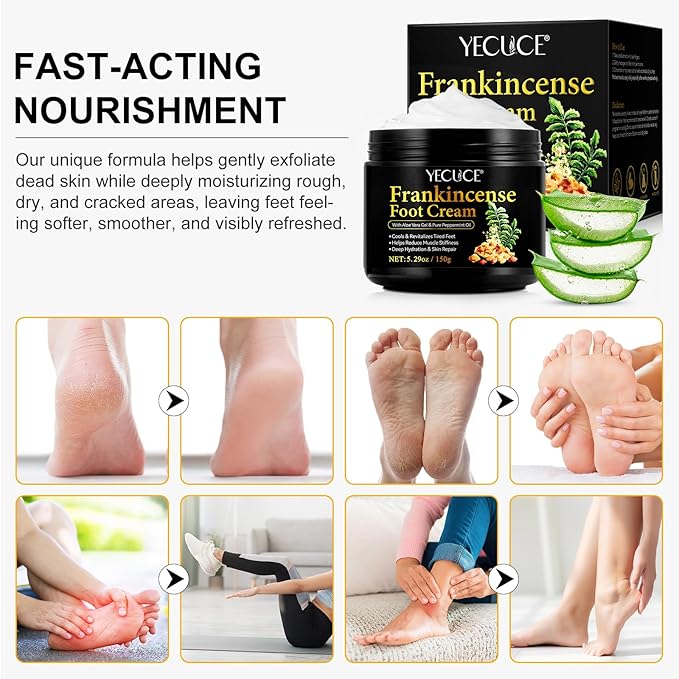 Frankincense Foot Cream 5.29oz, Frankincense Balm for Skin, Feet and Body Care, Deep Moisturizing and Soothing Skin with Pure Essential Oils for Dry, Cracked Heels