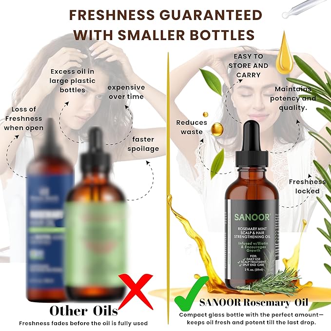 SANOOR® Rosemary Mint, Scalp Hair Growth Oil, Infused Biotin to Encourages Hair Growth | Healthier, Stronger & Long Strands | All Type & Texture | Straight, Waves & Chemically Treated Hairs