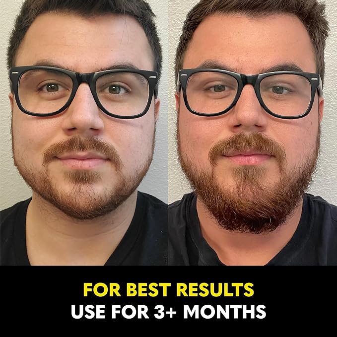 The Beard Club Biotin Vitamin Spray for Facial Hair Growth - Natural Formula for Fuller, Thicker Beard, Easy-to-Use, Nourishing & Soothing for All Beard Types & Skin