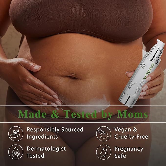 Abera Ovela Maternity Stretch Mark Cream with Eye Mask for Pregnancy and Weight Fluctuations, Stretch Mark Treatment Pregnancy Must Haves, Deep Stretch Mark Removal, All Skin Types, 1.69 fl oz