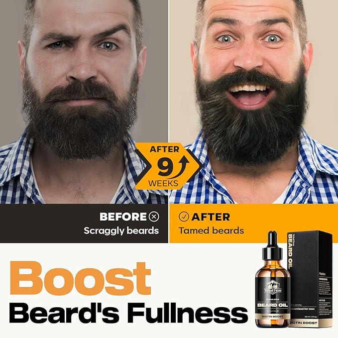 Waking Forest Beard Oil - Biotin Beard Oil for Men Thicker Beard with Vitamin E, Rosemary, Castor Mustache Oil for Black Men, Softens & Strengthens Beard Care Oil (Cedar 2oz)