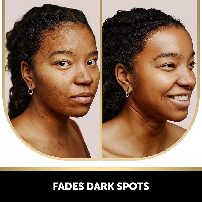 VALITIC 4 Pack Kojic Acid Vitamin C & Retinol Soap Bars for Dark Spot & A Pair of Black Exfoliating Gloves for Body Scrubs