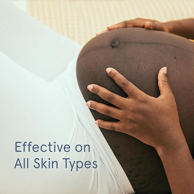 LOLA Stretch Mark Prevention Cream with Apricot Oil, Shea Butter, Vitamin E, Unscented