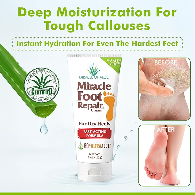 Aloe Vera Lotion & Foot Cream Combo – Aloe All Over 1 oz + Foot Repair 4 oz – Soothing Aloe Lotion for Dry Skin, Hands, Heels & Body – Diabetic-Safe Foot Cream for Cracked Feet