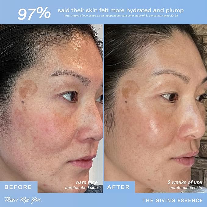 Then I Met You The Giving Essence, Hydrating and Brightening Face Treatment with Niacinamide & Fermented Ingredients, Vegan & Clean Skincare, 5.07 oz