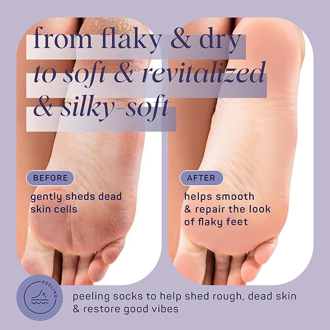 SpaLife Beauty Smooth Moves Peeling Foot Masks for Callus Removal – Foot Peel for Dry, Cracked Feet – Made with Natural Fruit Acids AHAs, Honey, Aloe, & Eucalyptus for Softer, Smoother Feet – 8 Pack