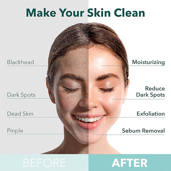 Purederm Deep Purifying Yellow O2 Bubble Mask Turmeric (5 Pack) – Bubble Face Sheet Mask for Purifying & Vitalizing