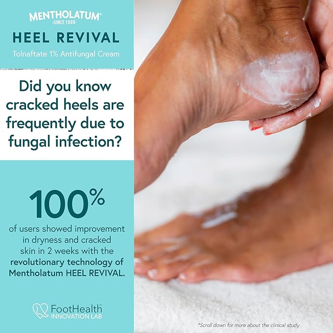 Mentholatum Heel Revival, Persistent Cracked Heel Repair Treatment, 1% Tolnaftate Antifungal Cream, Antifungal Foot Treatment, Eliminates & Prevents Fungus, 1 OZ
