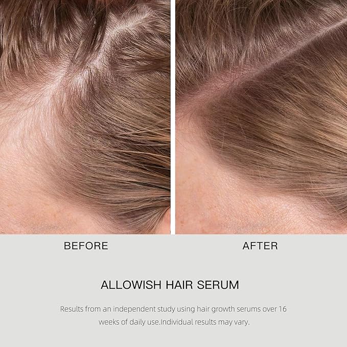 Hair Growth Serums 95 ml - Rosemary Hair Thickening Serum with Biotin, Caffeine for Hair Thinning & Shedding – Promotes Healthy Scalp, Fuller, Nourish, Strengthens Roots